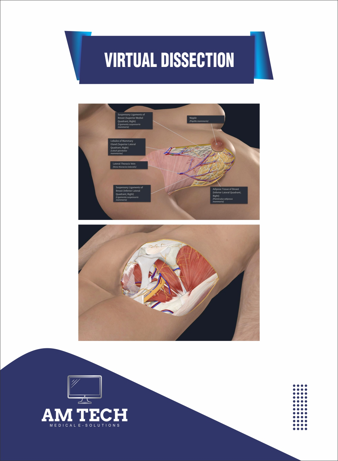 Virtual dissection workflow