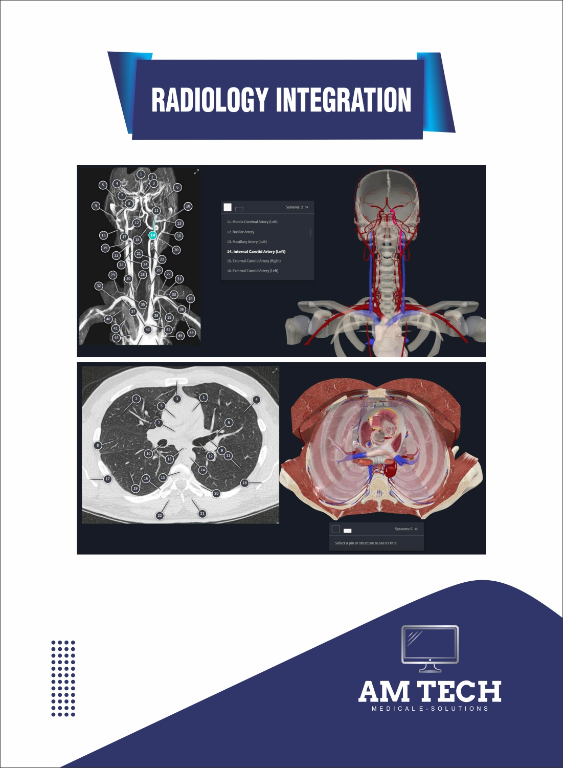 Layered anatomical exploration