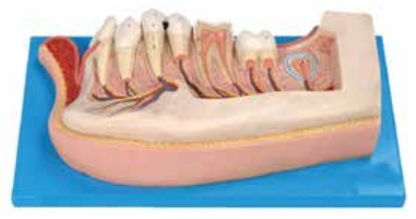 LOWER JAW OF 12-YEAR-OLD