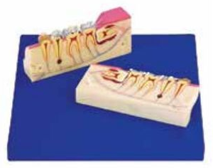 DISSECTED MODEL OF TEETH TISSUE