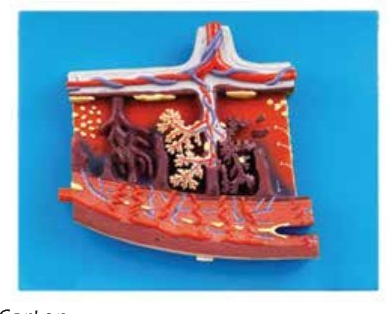 ENLARGED MODEL OF PLACENTA (SOFT)