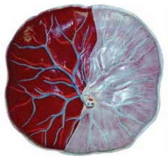 PLACENTA MODEL (SOFT)