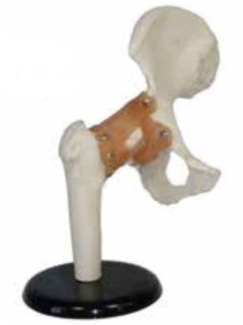 FUNCTIONAL HUMAN HIP JOINT