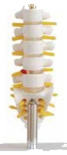 MINI LUMBER VERTEBRAE WITH SACRUM, COCCYX & HENIATED DISC