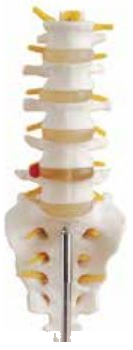 LIFE-SIZE LUMBER VERTEBRAE WITH SACRUM COCCYX & HENIATED DISC