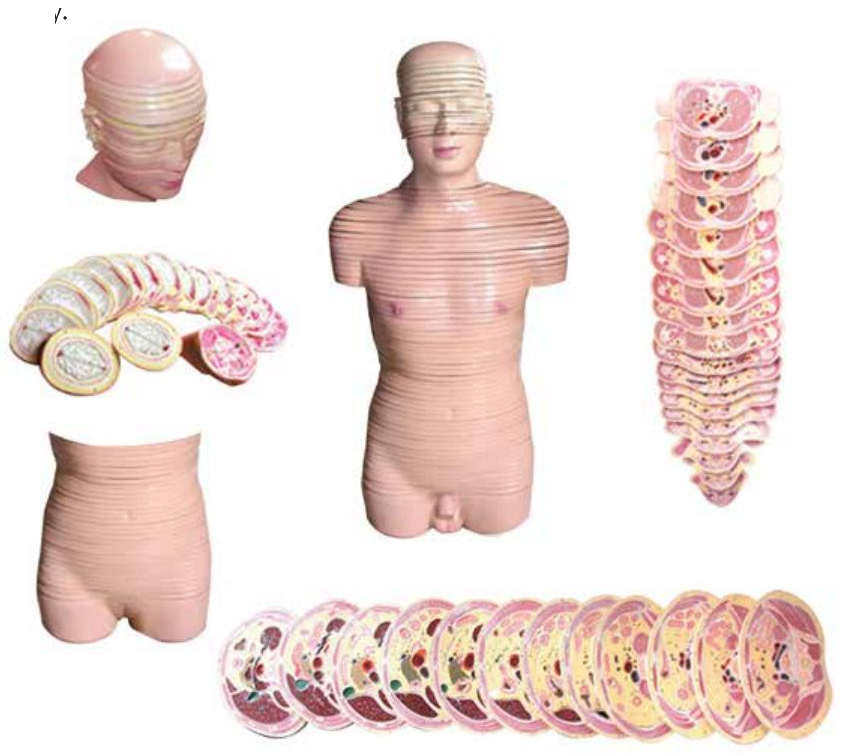 DELUXE MODEL OF HUMAN DISC TORSO (HORIZONTALLY SLICED)