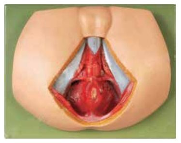 MALE PERINEUM ANATOMY (SOFT)