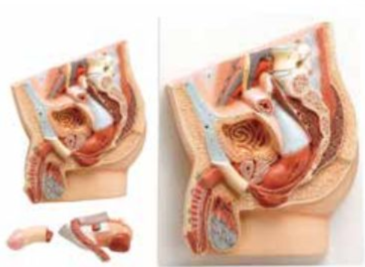 MEDIAN SECTION OF MALE PELVIS (SOFT)