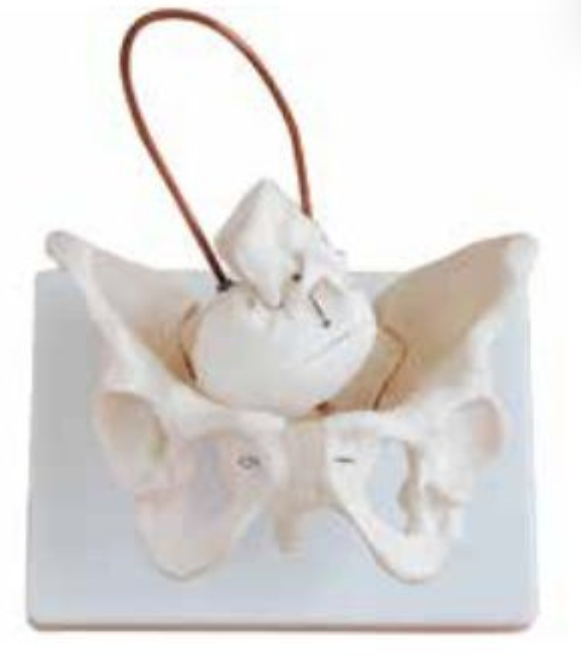 BIRTH DEMONSTRATION MODEL (BONY PELVIS WITH FETAL HEAD)