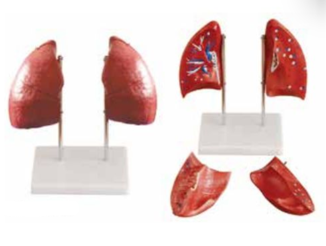 HUMAN LUNG MODEL (2 PARTS)