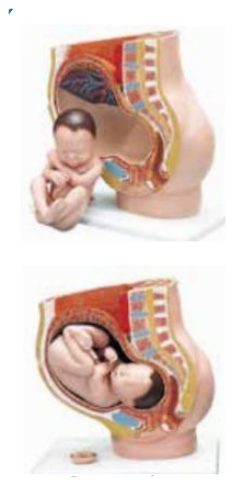 PELVIS WITH UTERUS IN NINE MONTH OF PREGNANCY