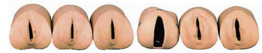MODEL OF VARIATION OF PRENATAL CERVIX AND BIRTH CANAL (SOFT)