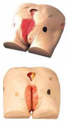 DECUBITUS WOUND CARE SIMULATOR (SOFT)